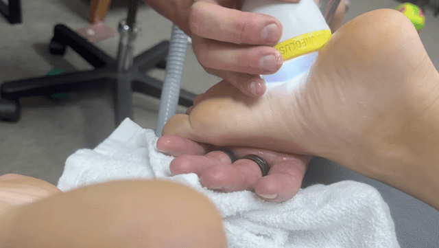 SoftWave therapy treatment for foot pain