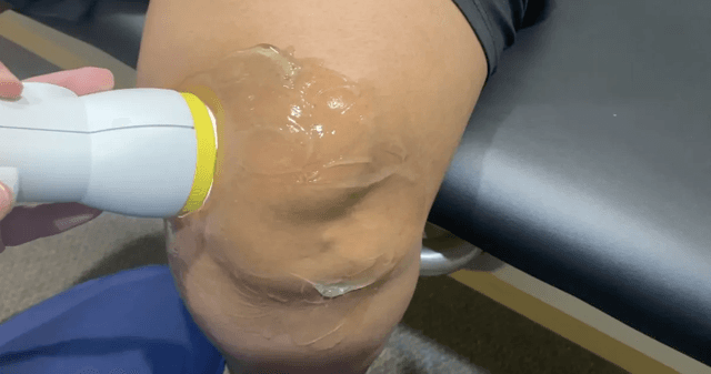 SoftWave therapy treatment for knee pain